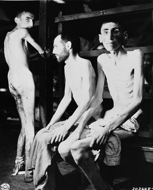 Buchenwald-Survivors-starvation-fatigue