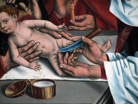 The Brit Milah (Circumcision) of Yeshua (Jesus) by Friedrich Herlin, 1466