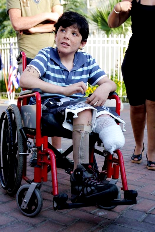 9-years_old_Israeli_boy_Osher_Twito_copes_with_lost_of_his_leg_after_Qassam_exploded_next_to_him_in_Sderot_Israel